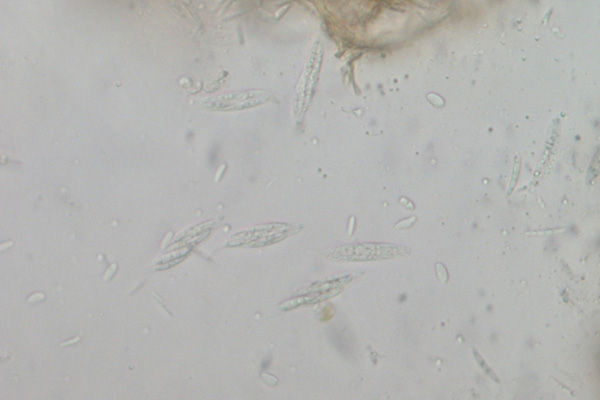 Foto 6. Aschi con ascospore di Gnomoniopsis