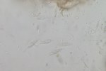 Foto 6. Aschi con ascospore di Gnomoniopsis