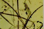 Esemplari di Ditylenchus dipsaci estratti da piante di aglio