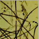 Esemplari di Ditylenchus dipsaci estratti da piante di aglio