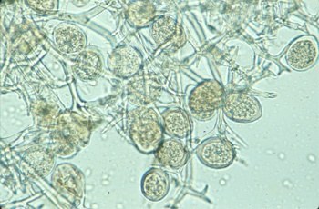 Micelio e sporangi di P. manshurica