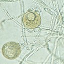 Strutture riproduttive del fungo: oogonio e anteridio (in Basso) e oospora in formazione (in alto)