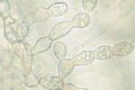 Micelio di Rhizoctonia solani