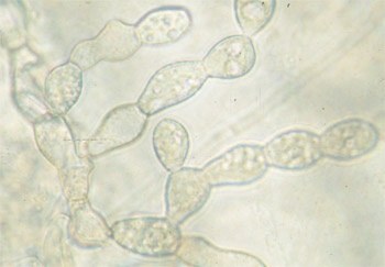 Micelio di Rhizoctonia solani
