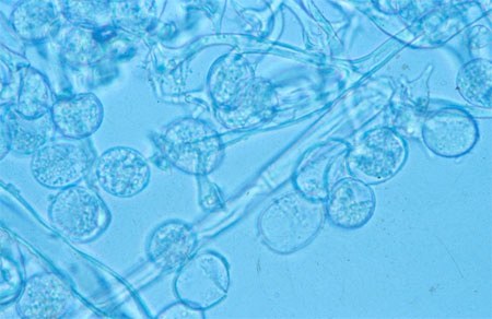 Sporangio-conidi di Bremia lactucae